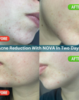 CELESTIAL DUO NOVA FACE SERUM REJUVENATION STARTER SET