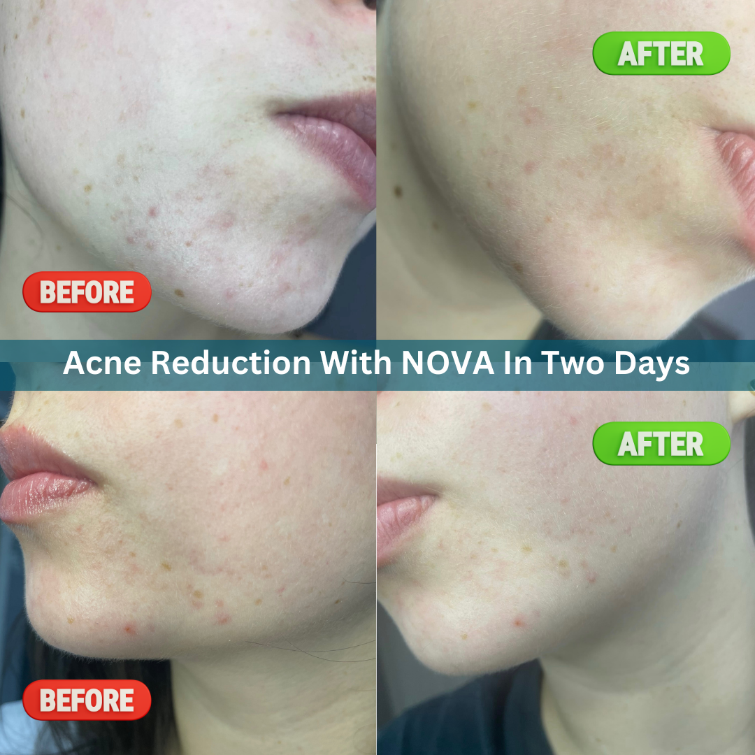 CELESTIAL DUO NOVA FACE SERUM REJUVENATION STARTER SET